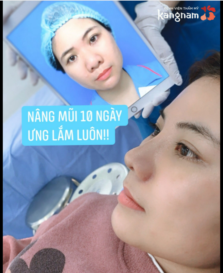 Mới 10 ngày mũi lên form, gom gọn siêu tự nhiên