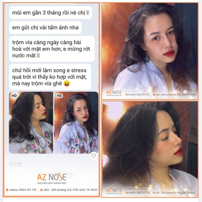 Mới nâng mũi xong em stress lắm!