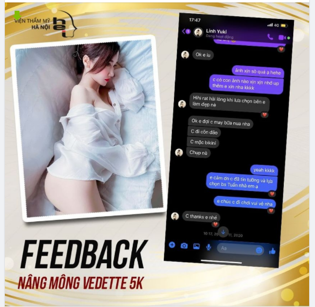 Một chiếc feedback đầu tuần xinh xinh của chị khách hàng khi thực hiện dịch vụ Nâng mông Vedette 5K tại Viện thẩm mỹ Hà Nội!