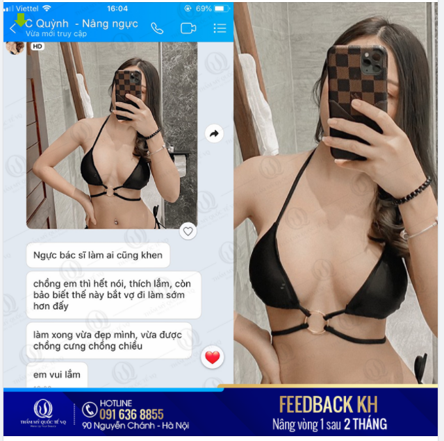 MỘT CHIẾC FEEDBACK V1 KHÔNG THỂ HẤP DẪN HƠN