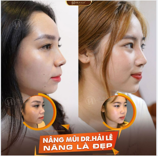 MỘT PHẪU THUẬT NHỎ - MỘT THAY ĐỔI LỚN.!!