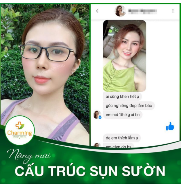 Mũi cấu trúc sụn sườn một khi đã vào dáng thì không chỉ góc nghiêng, ngay cả góc thẳng, góc đứng, góc nằm, góc ngồi, góc quỳ gì cũng đẹp tất tần tật
