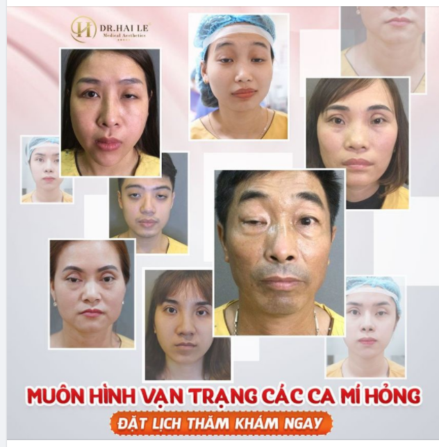 "Muôn hình vạn trạng" các trường hợp mí lỗi, hỏng cần được giải cứu
