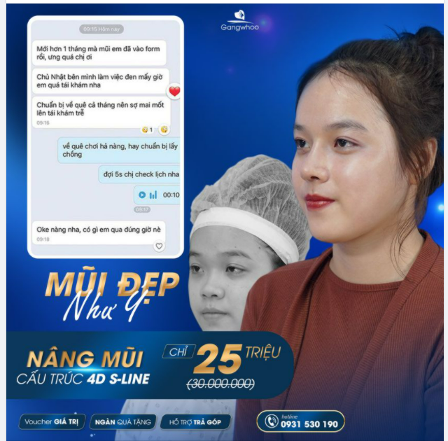 NÂNG CAO HẾT Ý – MŨI ĐẸP NHƯ Ý