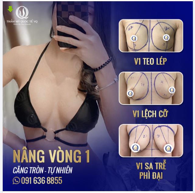 NÂNG CẤP SIÊU TỐC TĂNG SIZE TỨC THÌ FORM N.GỰC HOÀN HẢO