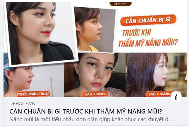 Nâng mũi là một tiểu phẫu đơn giản giúp khắc phục các khuyết điểm của chiếc mũi, giúp mũi bạn trở nên thon gọn, gương mặt cũng sẽ thanh thoát và cân đối hơn.