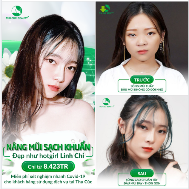 NÂNG MŨI SẠCH KHUẨN - ĐẸP CHUẨN HOTGIRL