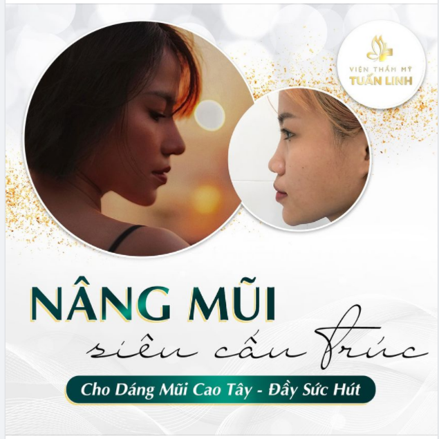 NÂNG MŨI SIÊU CẤU TRÚC - ĐỈNH CAO TRONG TẠO HÌNH MŨI CAO TÂY.