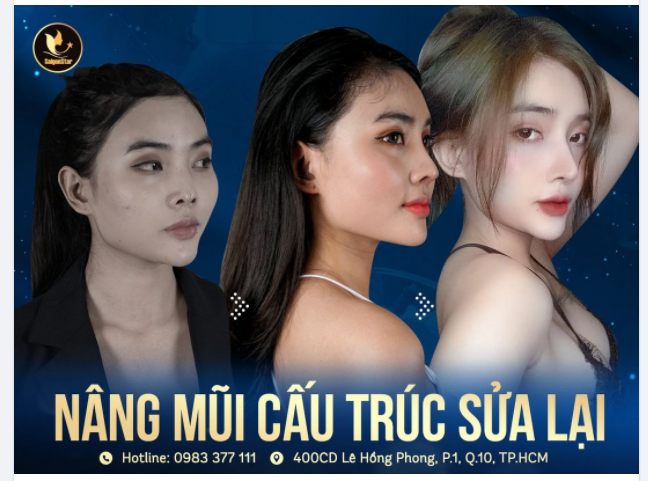 NÂNG MŨI SỬA LẠI - XINH ĐẸP MÃI MÃI