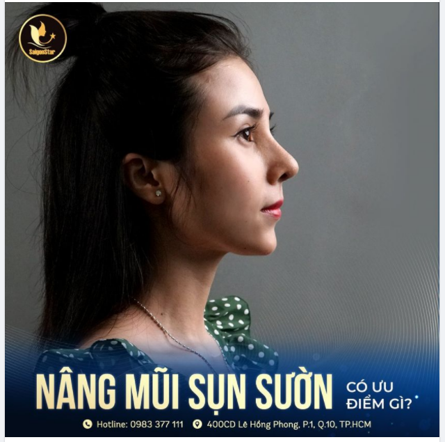 Nâng mũi sụn sườn là phương pháp nâng mũi sử dụng kết hợp giữa sụn tự thân và sụn nhân tạo.