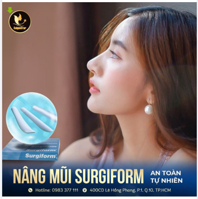 NÂNG MŨI SURGIFORM - XU HƯỚNG NÂNG MŨI MỚI NHẤT