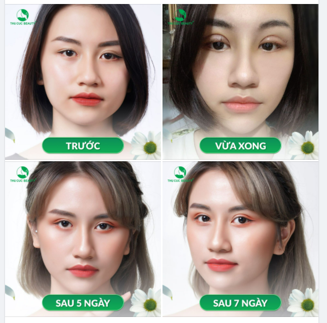 NẾP MÍ SẮC NÉT - MẮT ĐẸP HÚT HỒN