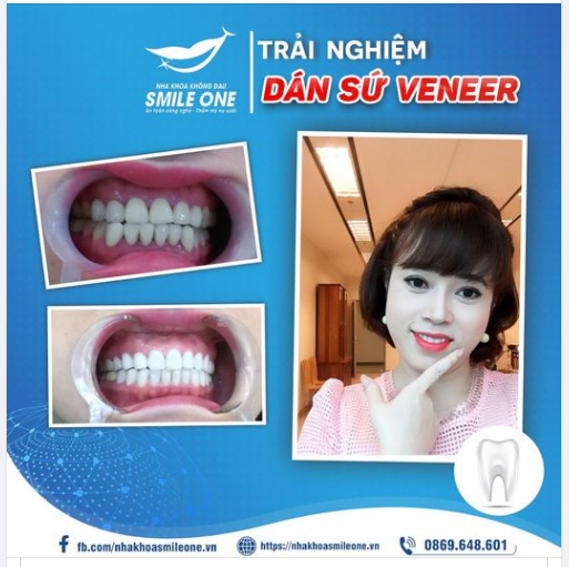 " Nếu khoảng cách giữa em và một nụ cười đẹp là một nghìn bước