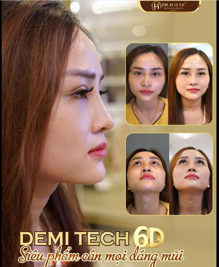 Nghe nói mọi người ở nhà ngày 10 lần lướt vào xem hình đẹp của Dr.Hải Lê đúng hông?