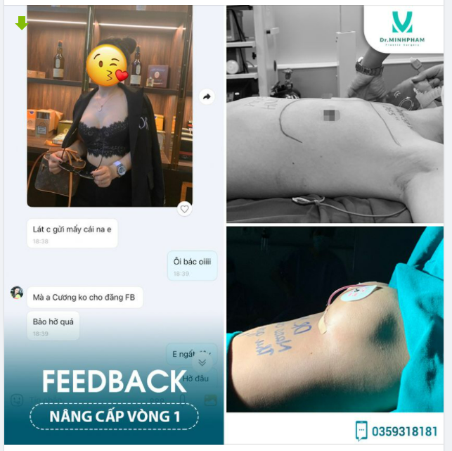 NGỰC ĐẸP – DẸP BỎ TỰ TI  Góc feedback: