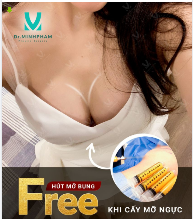 NGỰC NHỎ EO TO – LÀM GÌ CHO ĐẸP? COMBO HÚT MỠ BỤNG FREE CẤY MỠ NGỰC chính là giải pháp
