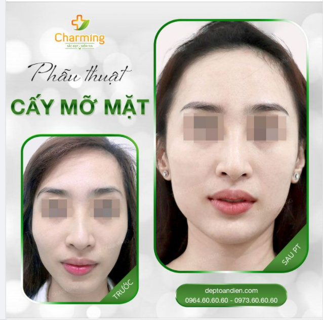 Người ta hay bảo “Không có người phụ nữ xấu, chỉ có người phụ nữ không biết mình đẹp và không biết cách làm đẹp”.