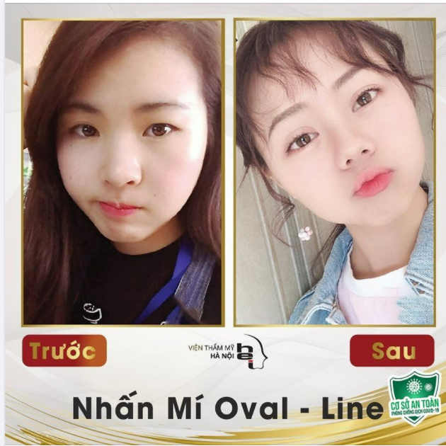 NHẤN MÍ NHẸ NHÀNG - NHAN SẮC THĂNG HẠNG