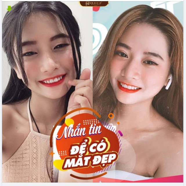 Nhắn tin để có mắt đẹp, mí xinh