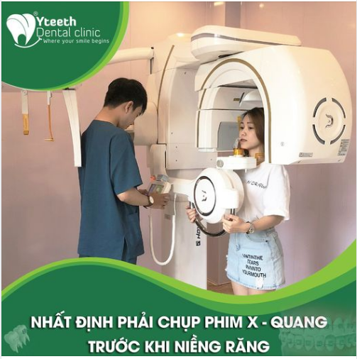 NHẤT ĐỊNH PHẢI CHỤP PHIM X - QUANG TRƯỚC KHI NIỀNG RĂNG