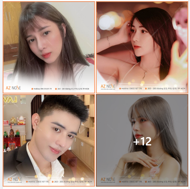 Nhìn lại những dáng mũi hơn 1 năm tuổi tại AZ NOSE