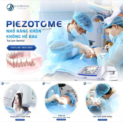 NHỔ RĂNG KHÔN KHÔNG ĐAU TẠI JUN DENTAL