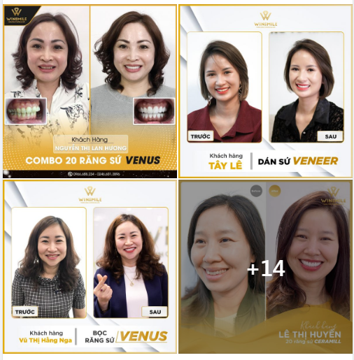 Những cuộc cách tân ngoạn mục nâng tầm nhan sắc