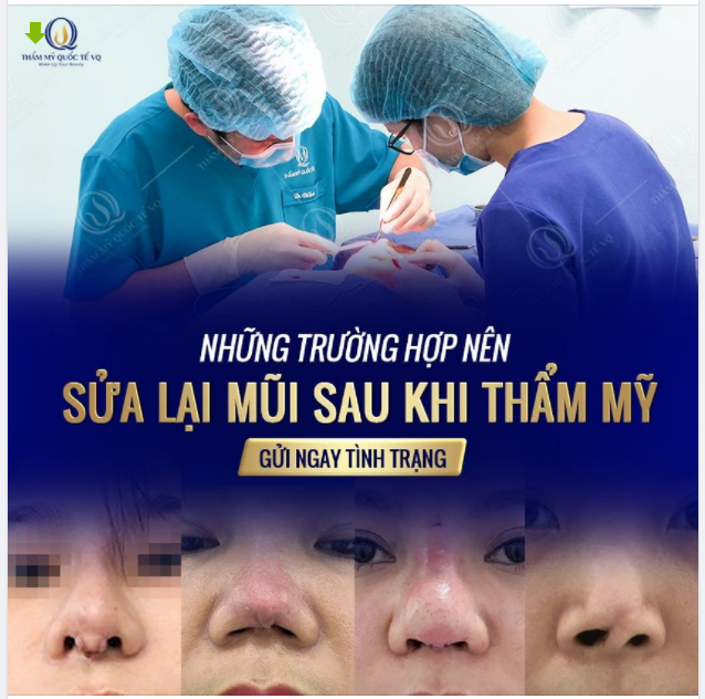 NHỮNG TRƯỜNG HỢP NÊN SỬA LẠI MŨI SAU KHI THẨM MỸ