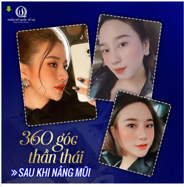 Niềm vui mỗi ngày của Bs Vũ Quang và ekip là nhận được những bức ảnh lung linh của KH sau khi sử dụng dịch vụ