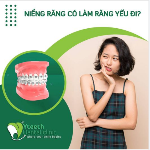 NIỀNG RĂNG CÓ LÀM RĂNG YẾU ĐI?