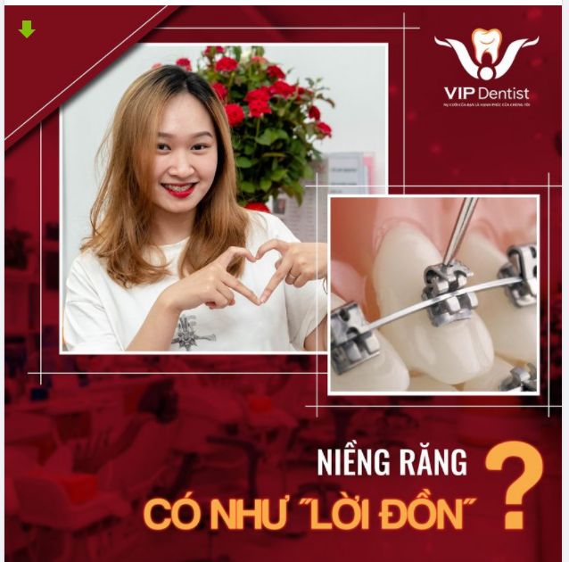 NIỀNG RĂNG CÓ NHƯ "LỜI ĐỒN"?