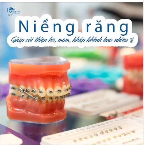 NIỀNG RĂNG CÓ THỰC SỰ HIỆU QUẢ
