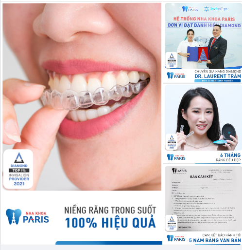 NIỀNG RĂNG INVISALIGN - 6 tháng đều đẹp