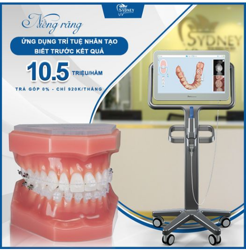 NIỀNG RĂNG KẾT HỢP CÔNG NGHỆ TUYỆT ĐỈNH