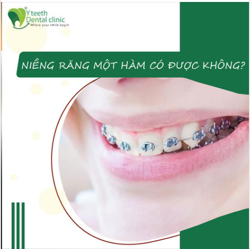 NIỀNG RĂNG MỘT HÀM CÓ ĐƯỢC KHÔNG?