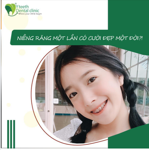 NIỀNG RĂNG MỘT LẦN CÓ CƯỜI ĐẸP MỘT ĐỜI?!