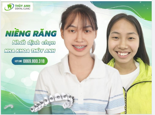 NIỀNG RĂNG NGAY ĐÁNH BAY HÔ, KHẤP KHỂNH