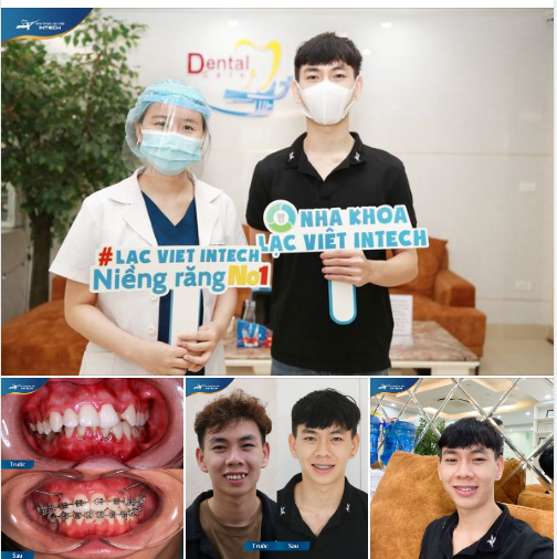 NIỀNG RĂNG SẼ THAY ĐỔI CON NGƯỜI BẠN NHƯ THẾ NÀO?