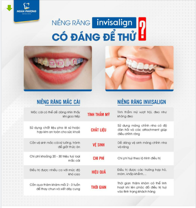 NIỀNG RĂNG TRONG SUỐT CÓ ĐÁNG ĐỂ THỬ?