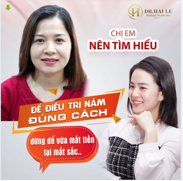 NỖI ÁM ẢNH "MẤT TIỀN, MẤT SẮC". LÀM SAO ĐỂ ĐIỀU TRỊ NÁM DA ĐÚNG CÁCH...