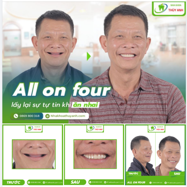 NỤ CƯỜI CỦA KHÁCH HÀNG LÀ ĐỘNG LỰC VÔ CÙNG LỚN CỦA CHÚNG TÔI
