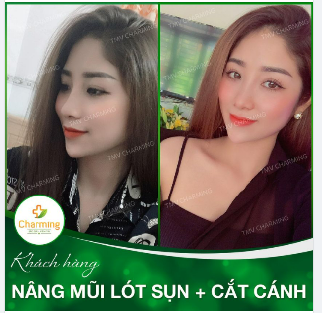 Ố là la, ai mà xinh thế ta?