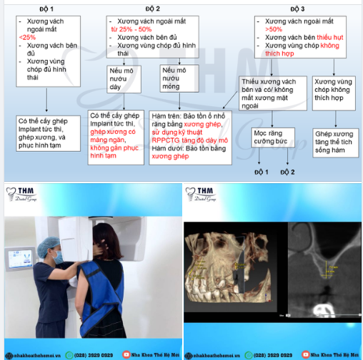 PHÂN TÍCH CHẤT LƯỢNG XƯƠNG Ổ RĂNG - YẾU TỐ KHÔNG THỂ BỎ QUA NẾU MUỐN CẤY GHÉP IMPLANT TỨC THÌ