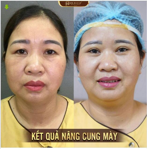 Phụ nữ có 2 thứ nhất định nên có: " Một là người đàn ông cuộc đời, hai là vẻ tươi trẻ trong đôi mắt"