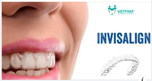 QUY TRÌNH NIỀNG RĂNG INVISALIGN ĐƯỢC THỰC HIỆN NHƯ THẾ NÀO?