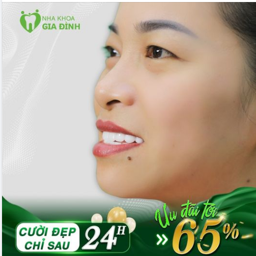 RĂNG ĐẸP NHƯ MƠ – ƯU ĐÃI BẤT NGỜ