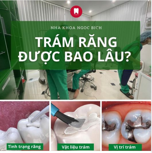 RĂNG SAU TRÁM CÓ GIỮ ĐƯỢC LÂU KHÔNG?