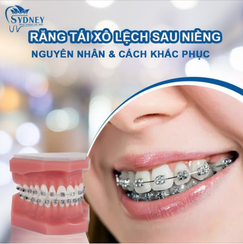 RĂNG TÁI XÔ LỆCH SAU NIỀNG