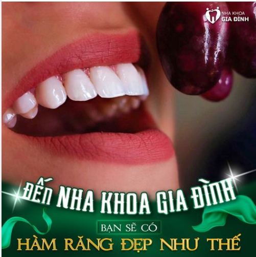 RĂNG TRẮNG HOÀN HẢO – ĐẢM BẢO CƯỜI XINH