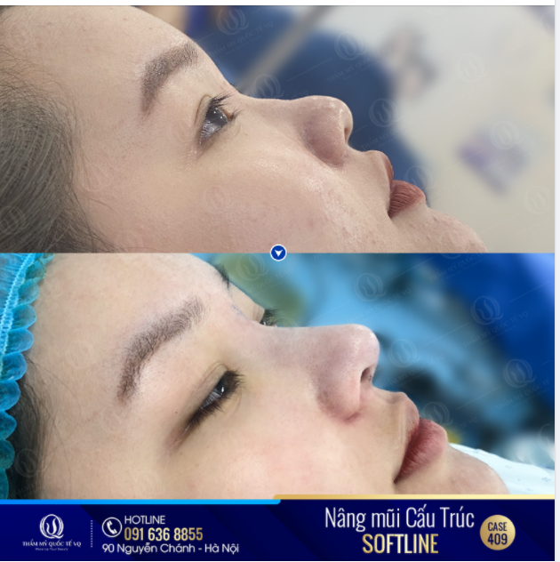 Rất nhiều mong muốn và dự định ấp ủ bấy lâu đều chưa thực hiện được chỉ vì lý do "mặt chưa xinh"